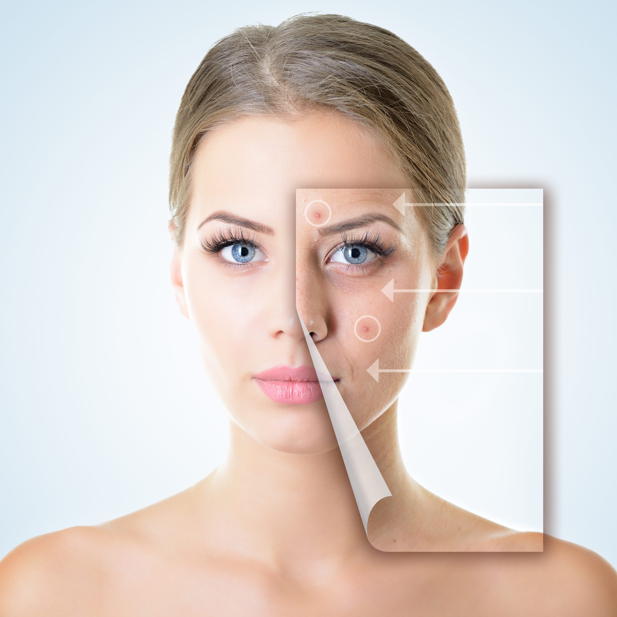 تزریق ژل و بوتاکس با متریال معتبر در کلینیک افرا